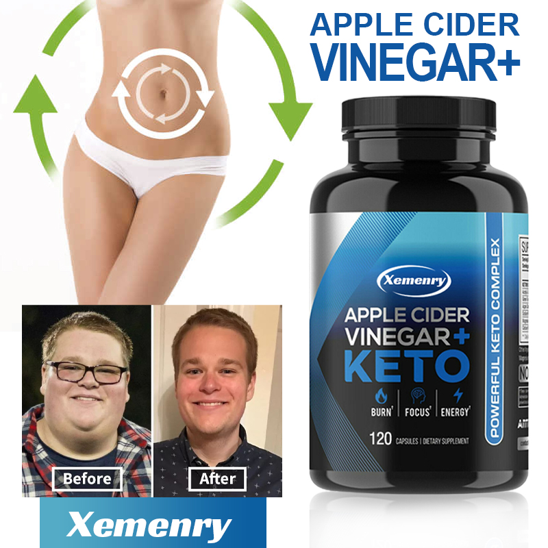 Apple Cider Vinegar Pill - Keto appelazijncapsule - ondersteunt eetlust, metabolische